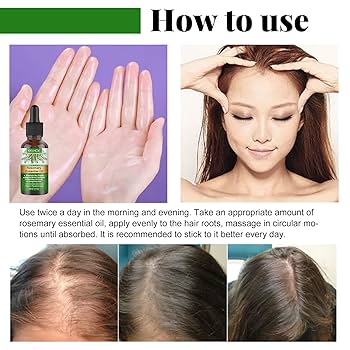 hair care Timi Hair Combo エッセンシャルオイル(育毛) Amazon.co.jp: 120ml Hair Growth Spray, Hair Growth Serum